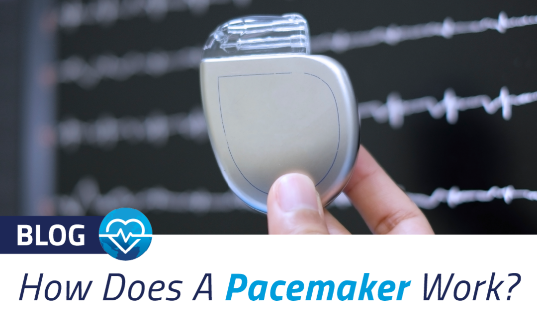 How Does a Pacemaker Work?