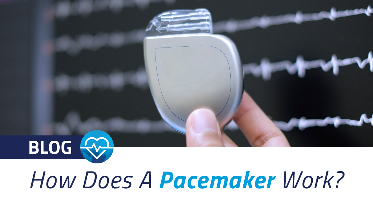 How Does a Pacemaker Work? | ForHearts Worldwide