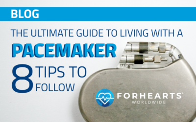 The Ultimate Guide to Living with a Pacemaker: 8 Tips to Follow