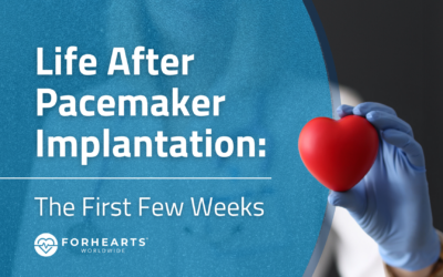 Life After Pacemaker Implantation: The First Few Weeks