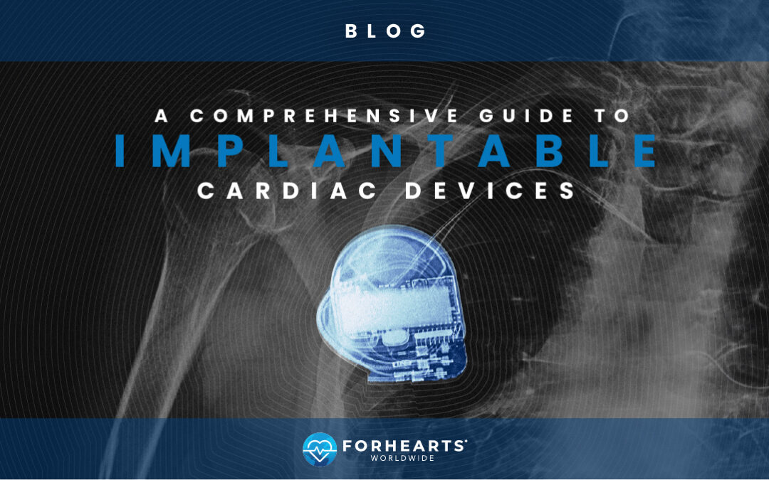 A Comprehensive Guide to Implantable Cardiac Devices