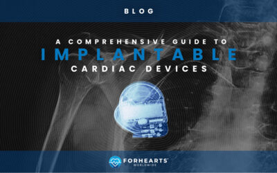 A Comprehensive Guide to Implantable Cardiac Devices