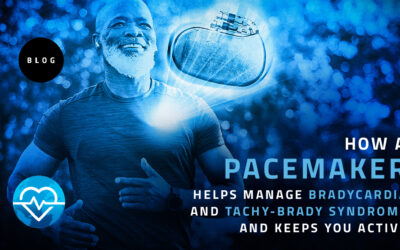 How a Pacemaker Helps Manage Bradycardia and Tachy-Brady Syndrome — And Keeps You Active